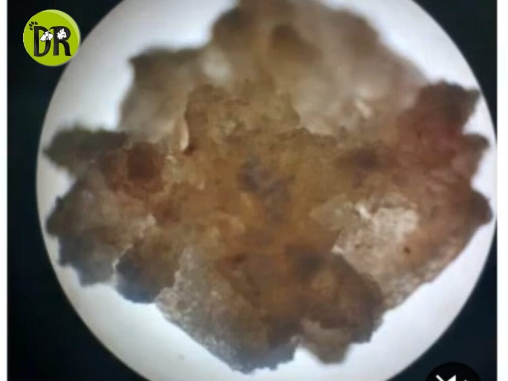 Bladder Stones in Cats 1 WhatsApp Image 2025 09 02 at 1.51.19 PM 1